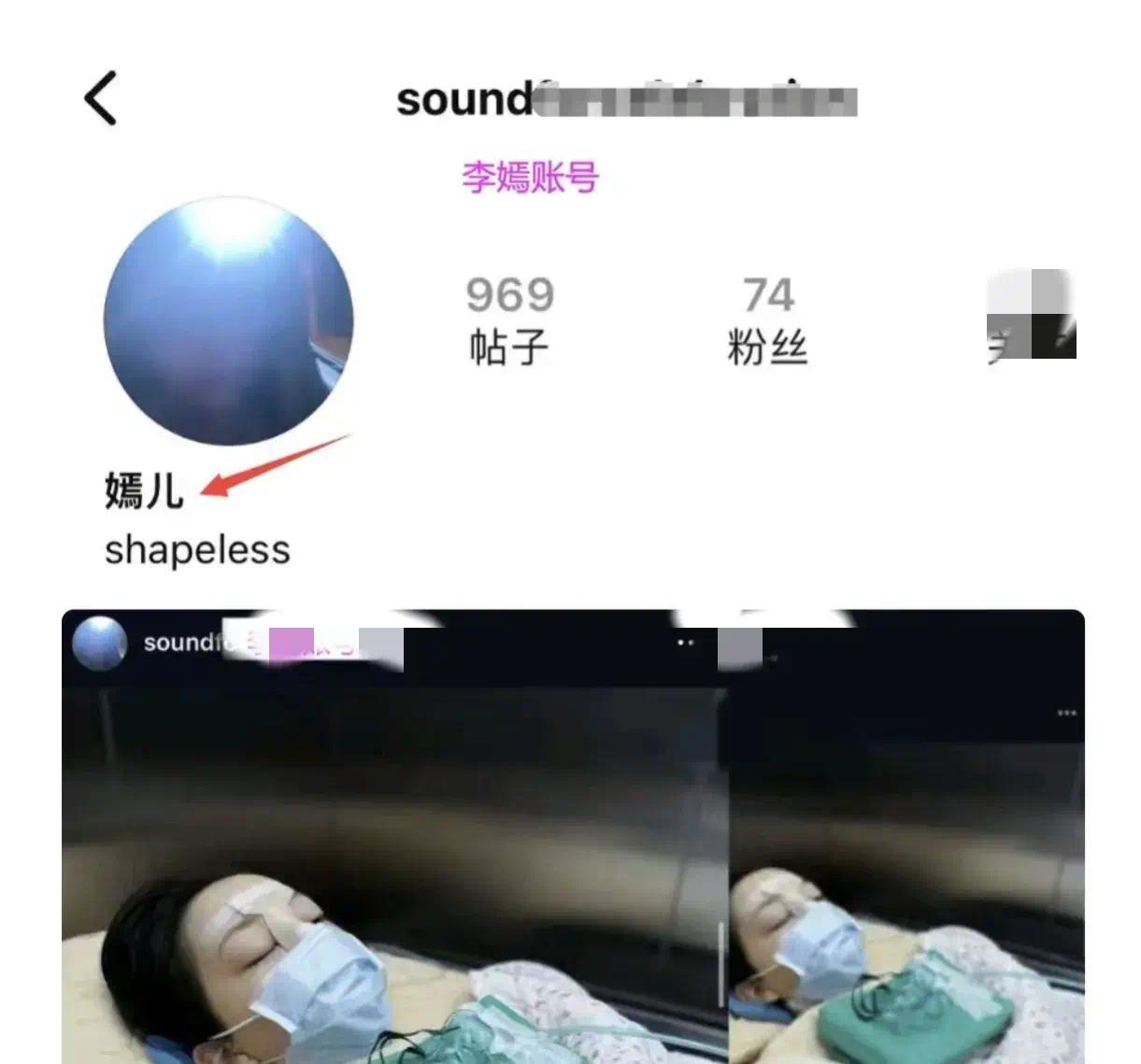 天后王菲宝贝女儿疑似再上手术台，术后照曝光，满脸纱布让人心疼不已插图